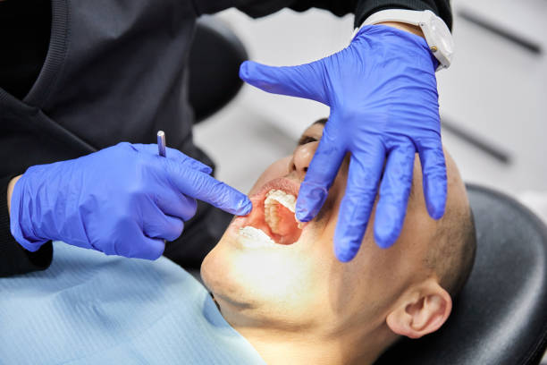 Best Root Canal Emergency Dentist  in Spruce Pine, NC