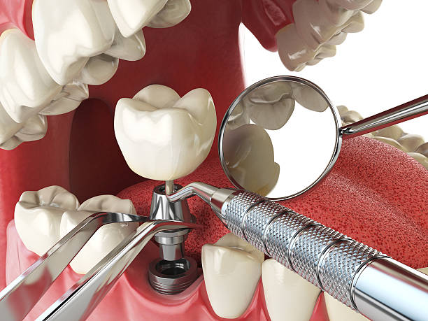 Best Emergency Tooth Extraction  in Spruce Pine, NC
